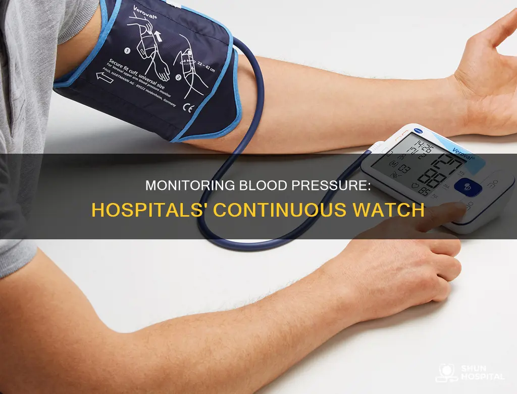 how do hospitals constantly monitor blood pressure