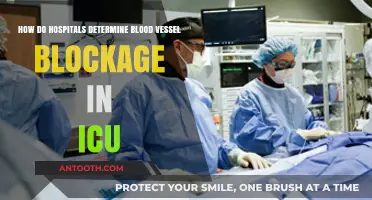 ICU Blood Vessel Blockage Detection: Hospital Diagnostic Techniques Explained