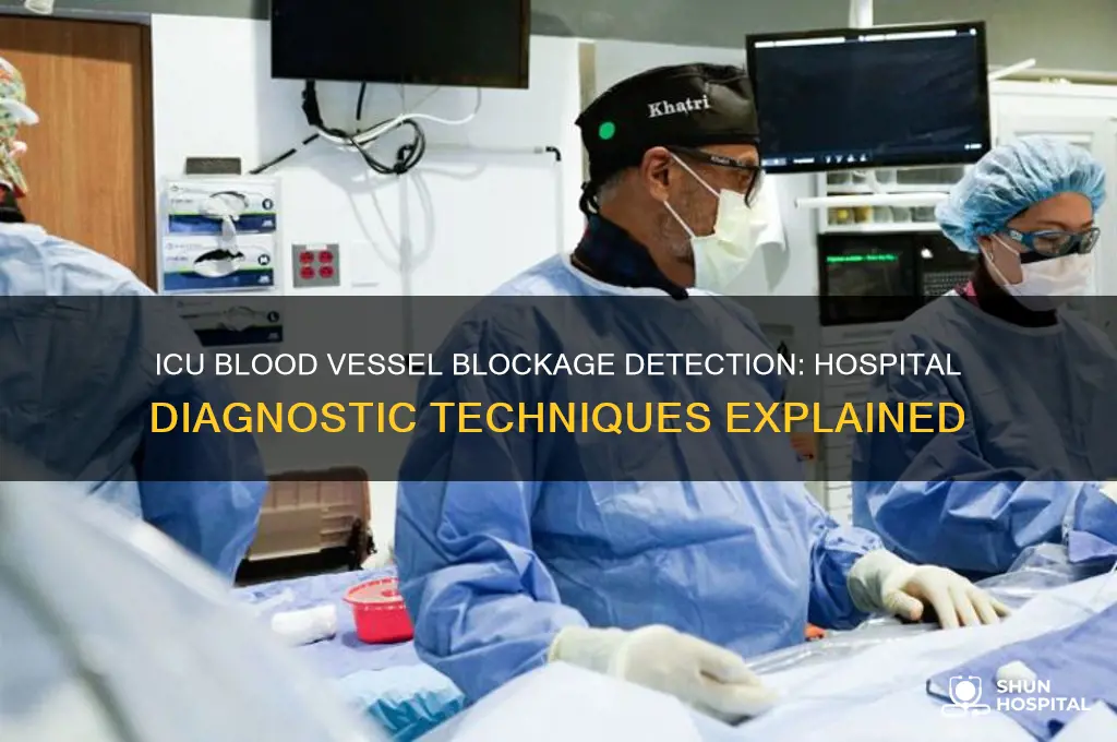 how do hospitals determine blood vessel blockage in icu