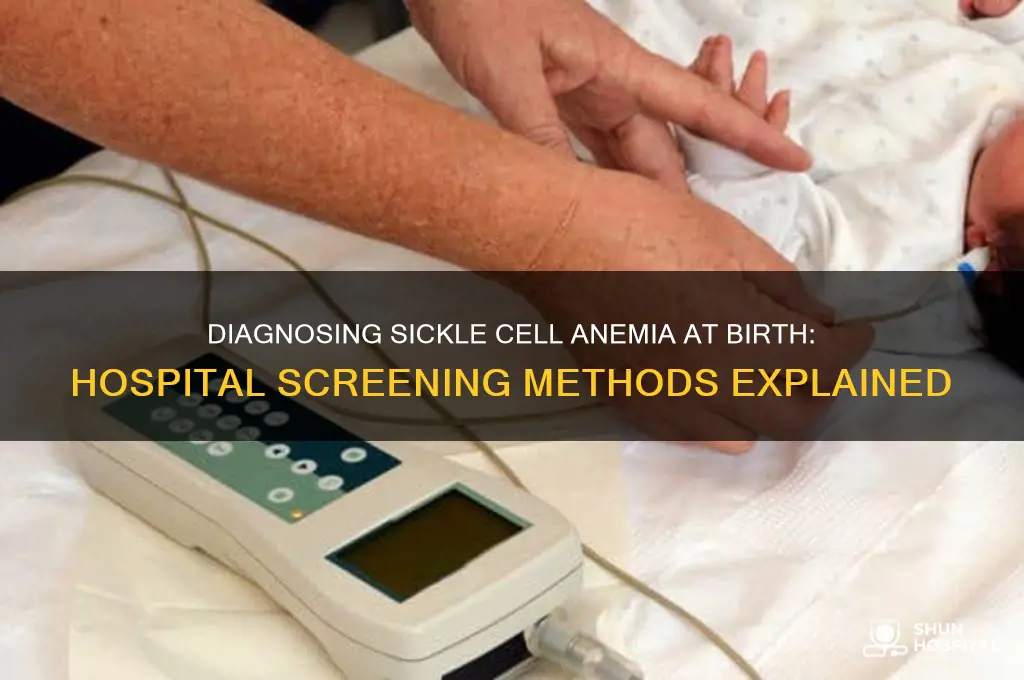 how do hospitals diagnose sickle cell anemia at brith