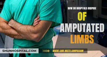 The Gruesome Truth About Amputated Limbs Disposal in Hospitals
