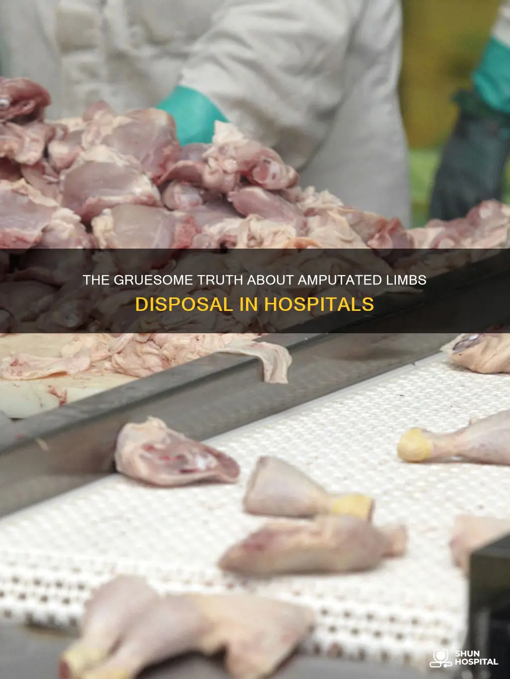 how do hospitals dispose of amputated limbs