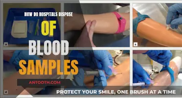 Hospitals' Safe Blood Sample Disposal Methods Explained