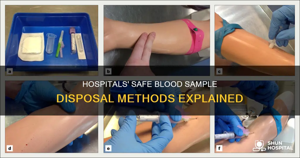 how do hospitals dispose of blood samples