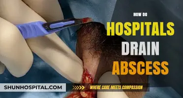Effective Abscess Drainage Techniques: A Hospital's Step-by-Step Approach
