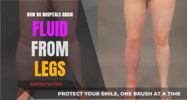 Leg Fluid Drainage: Hospital Procedure Explained