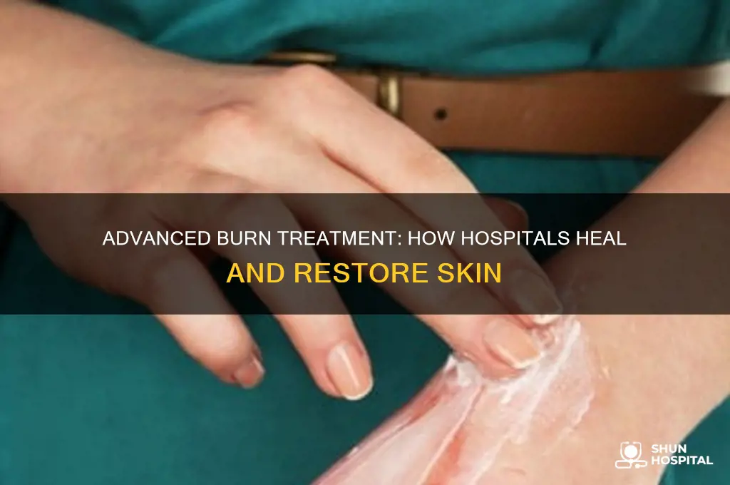how do hospitals heal burns