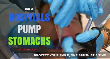 Understanding Gastric Lavage: How Hospitals Safely Pump Stomachs