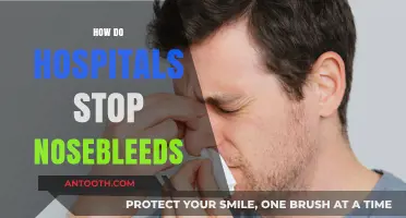Effective Hospital Techniques to Stop Nosebleeds Quickly and Safely