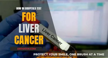 Liver Cancer Diagnosis: Hospital Testing Methods and Procedures