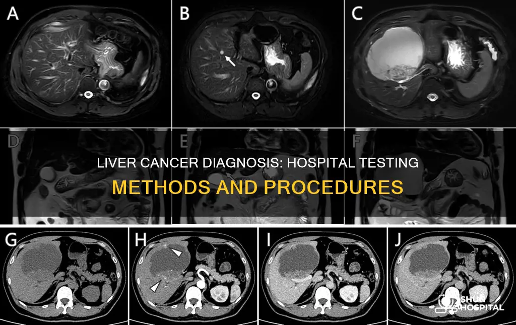 how do hospitals test for liver cancer