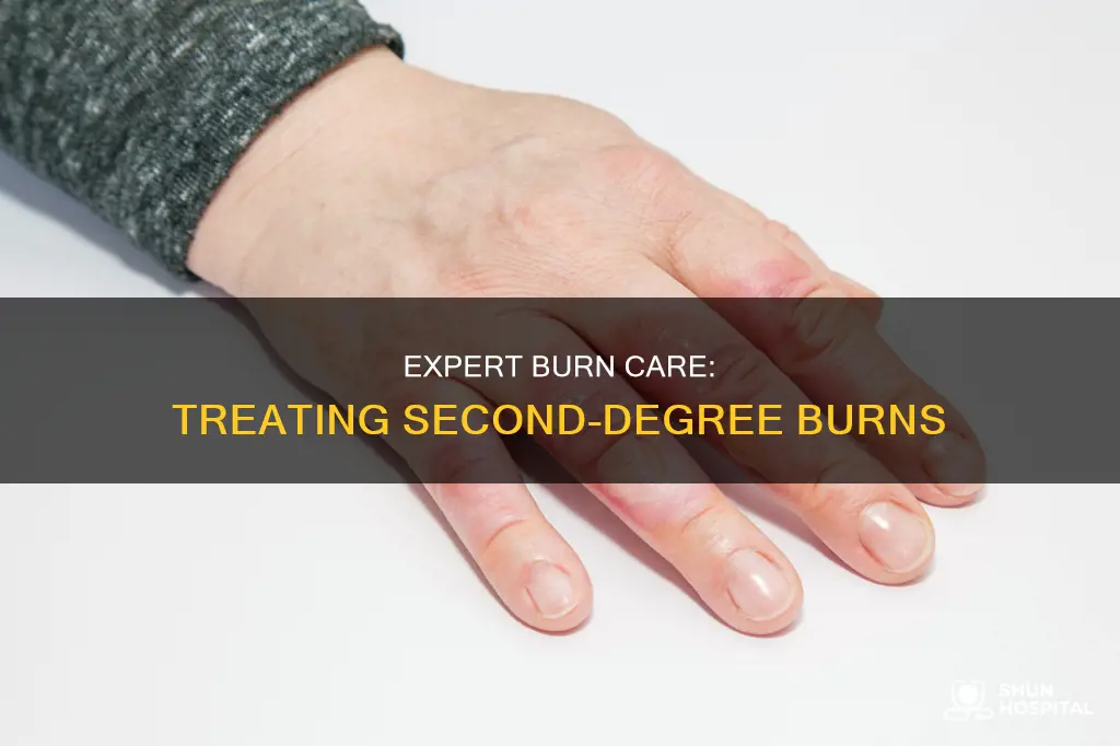 how do hospitals treat 2nd degree burns
