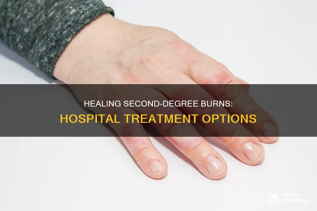 how do hospitals treat 2nd dregree burns