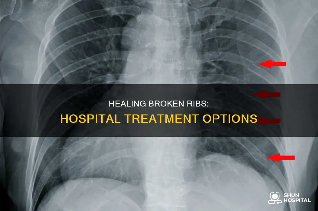 how do hospitals treat a broken rib