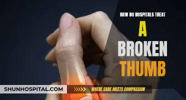 Healing a Broken Thumb: Hospital Treatment Options