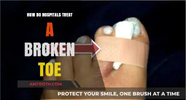 Healing Broken Toes: Hospital Treatment Options