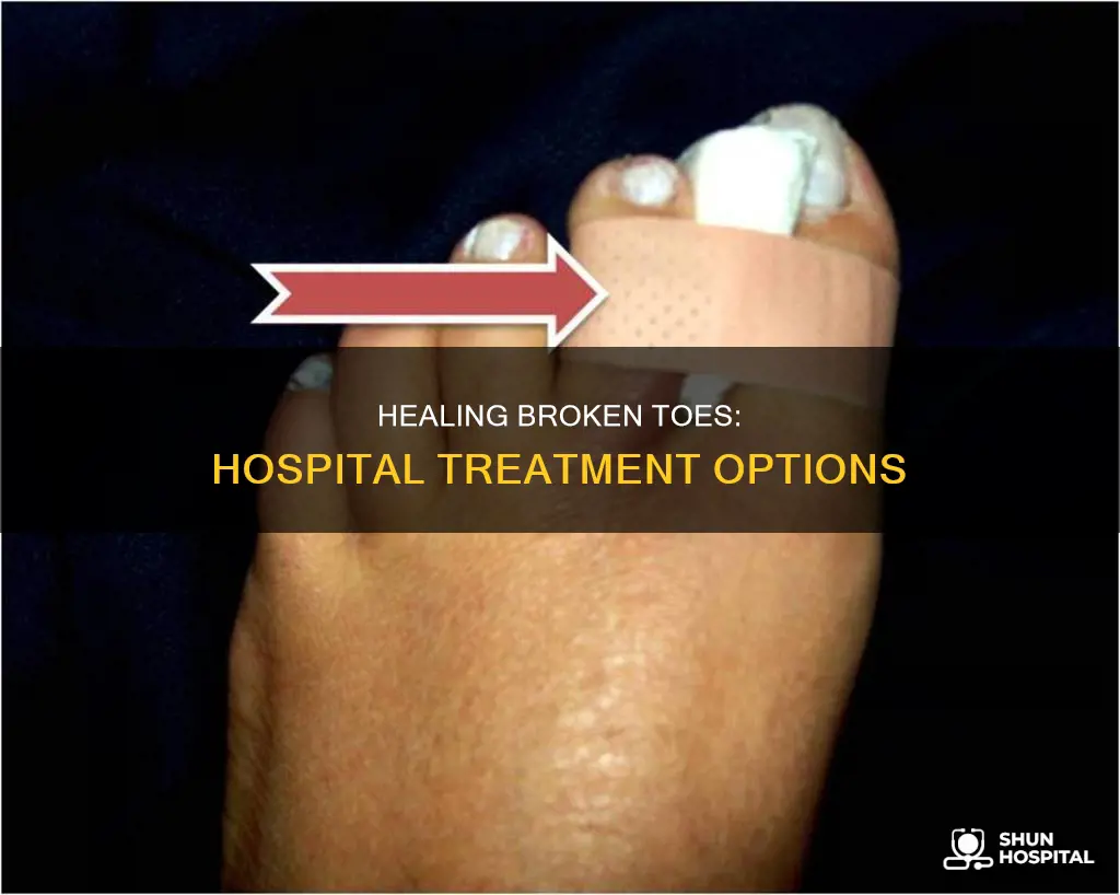 how do hospitals treat a broken toe