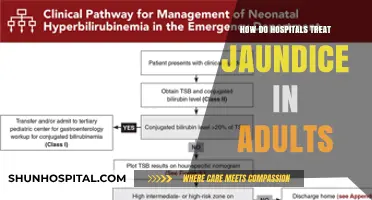 Hospitals' Jaundice Treatment Methods for Adults