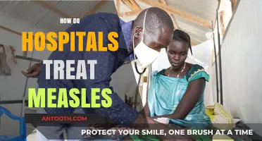 Effective Measles Treatment Strategies in Hospitals: A Comprehensive Guide