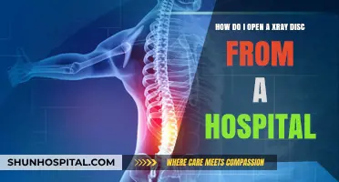 How to Safely Open and Access Your Hospital X-Ray Disc