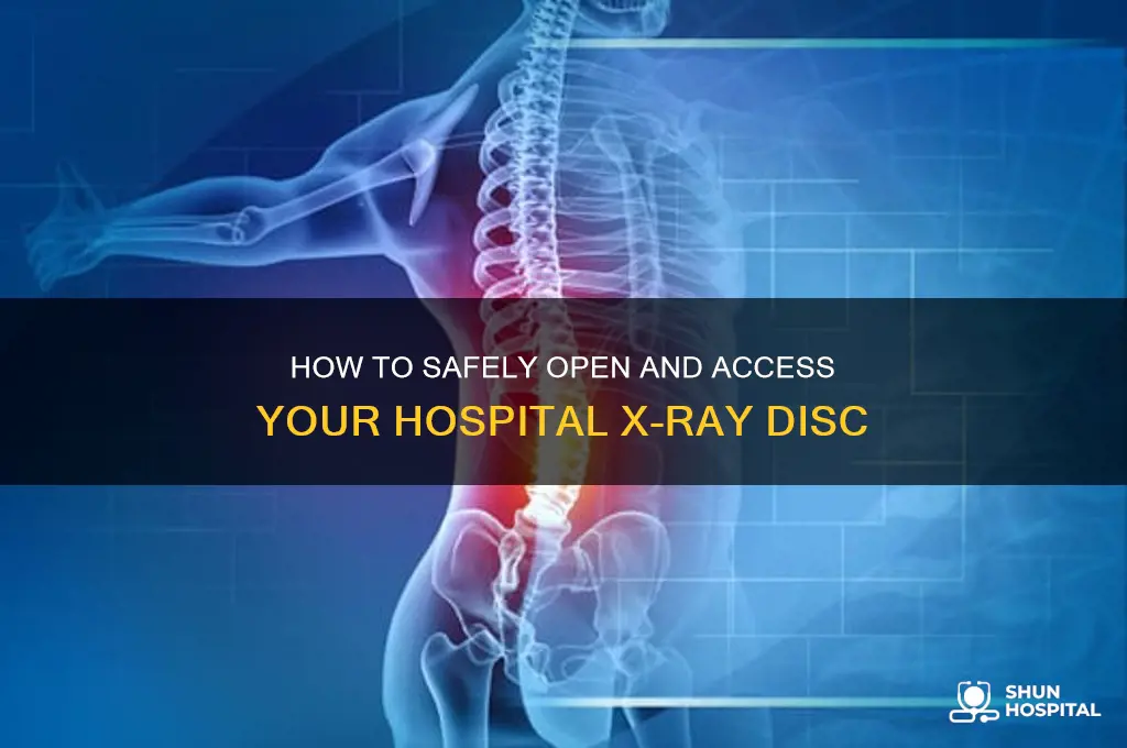 how do i open a xray disc from a hospital