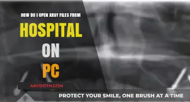 How to Open and View Hospital X-Ray Files on Your PC