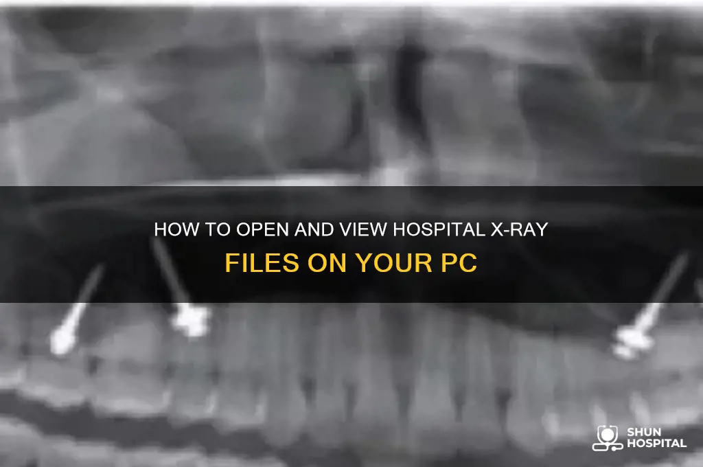 how do i open xray files from hospital on pc