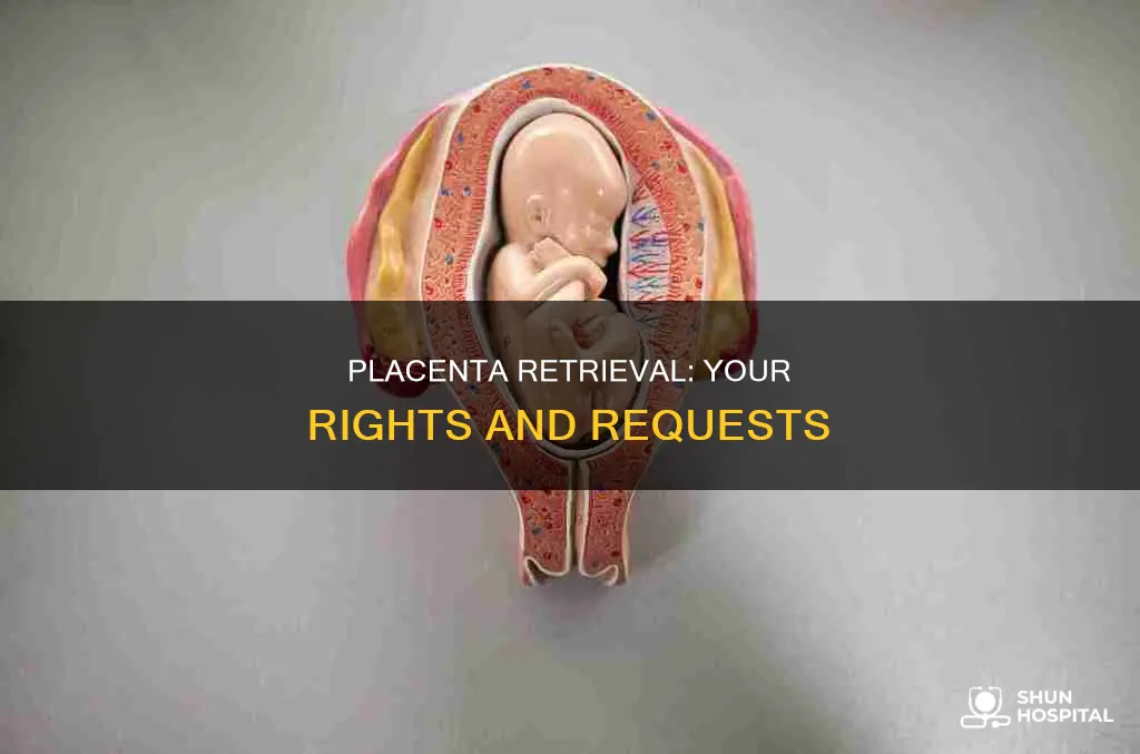 how do i request placenta from hospital