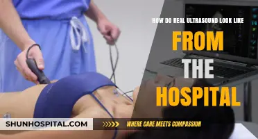 Real Ultrasound Images: A Glimpse into Hospital Scans and Their Appearance