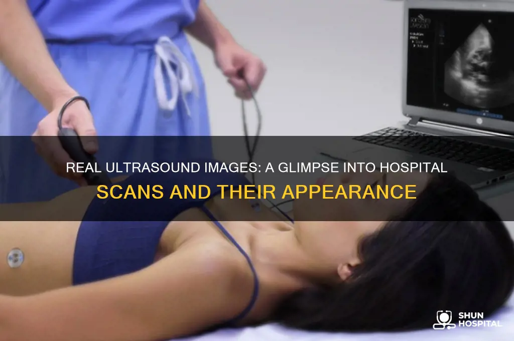 how do real ultrasound look like from the hospital