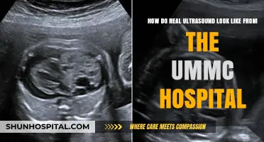 Real Ultrasound Images: A Glimpse from UMMC Hospital