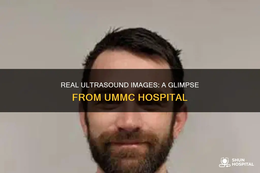 how do real ultrasound look like from the ummc hospital