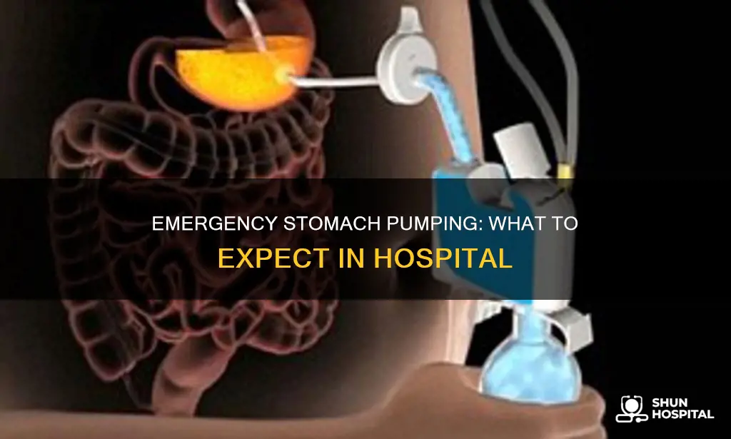 how do the hospital pump your stomach