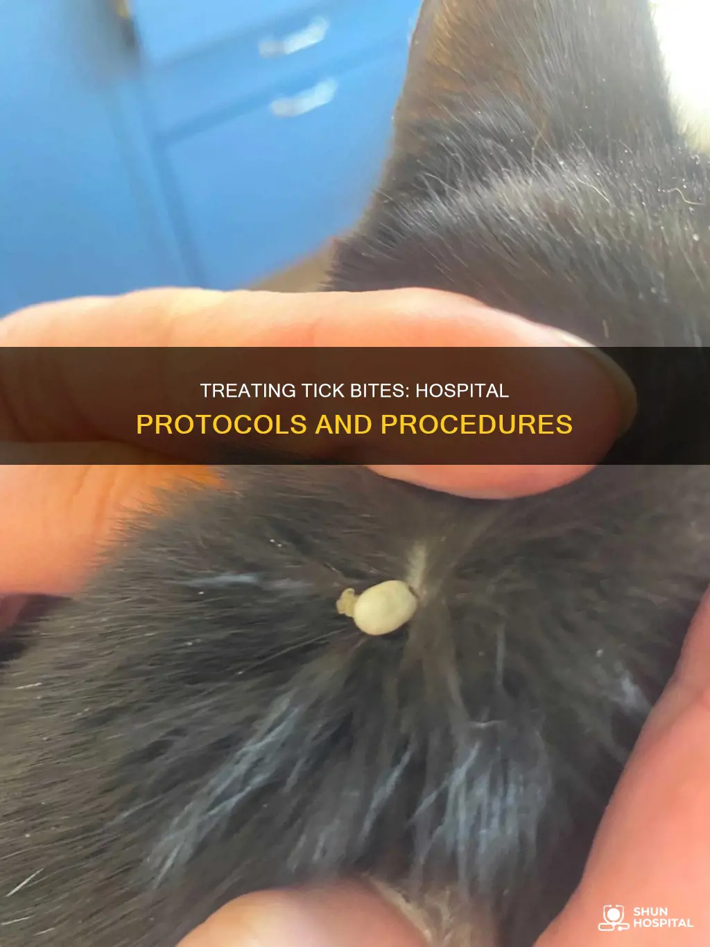 how do the hospital treat tick bites