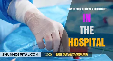 Dissolving Blood Clots: Hospital Treatments and Procedures Explained