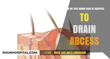 Pain-Free Abscess Drainage: How Hospitals Numb Skin for Effective Treatment