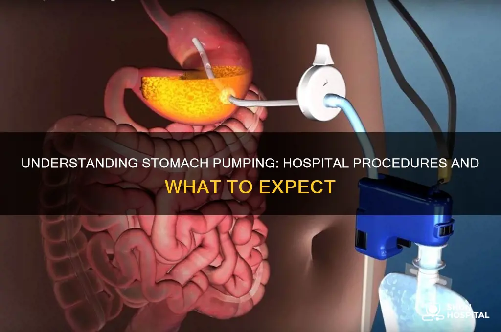 how do they pump your stomach at the hospital