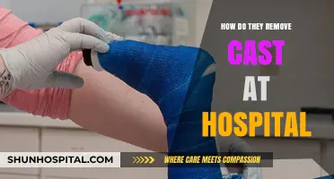 Effective Techniques for Removing Hospital Casts