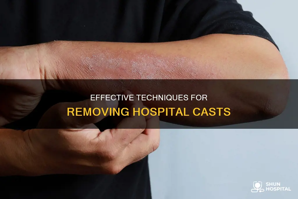 how do they remove cast at hospital