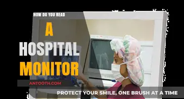 Interpreting Hospital Monitor Data: A Beginner's Guide