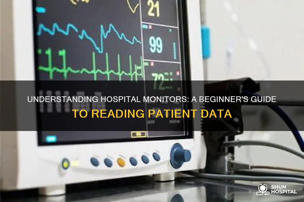 how do you read a monitor in the hospital