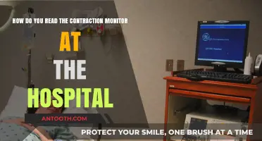 Decoding Hospital Contraction Monitors: A Step-by-Step Guide for Expectant Parents