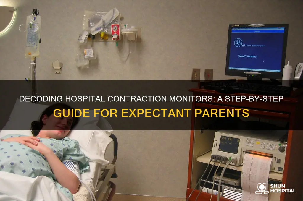 how do you read the contraction monitor at the hospital