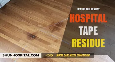 Effective Ways to Remove Hospital Tape Residue