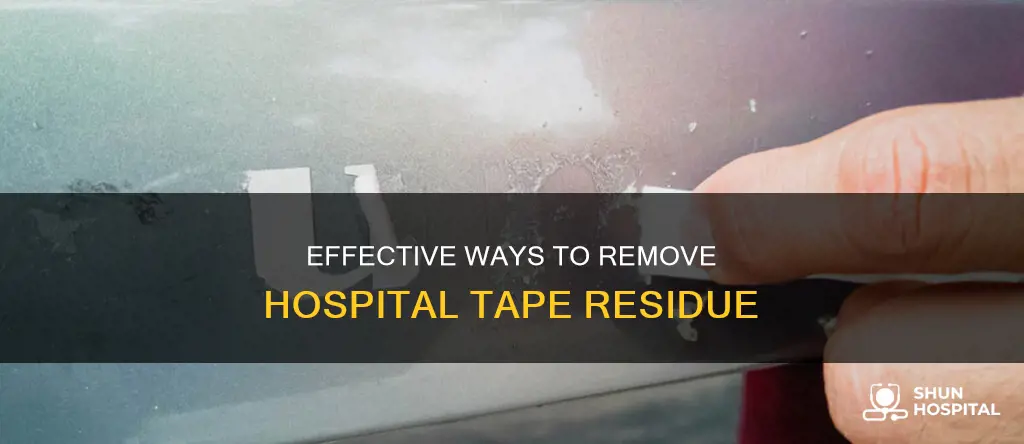 how do you remove hospital tape residue