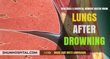 Emergency Treatment: Removing Water from Lungs After Drowning in Hospitals
