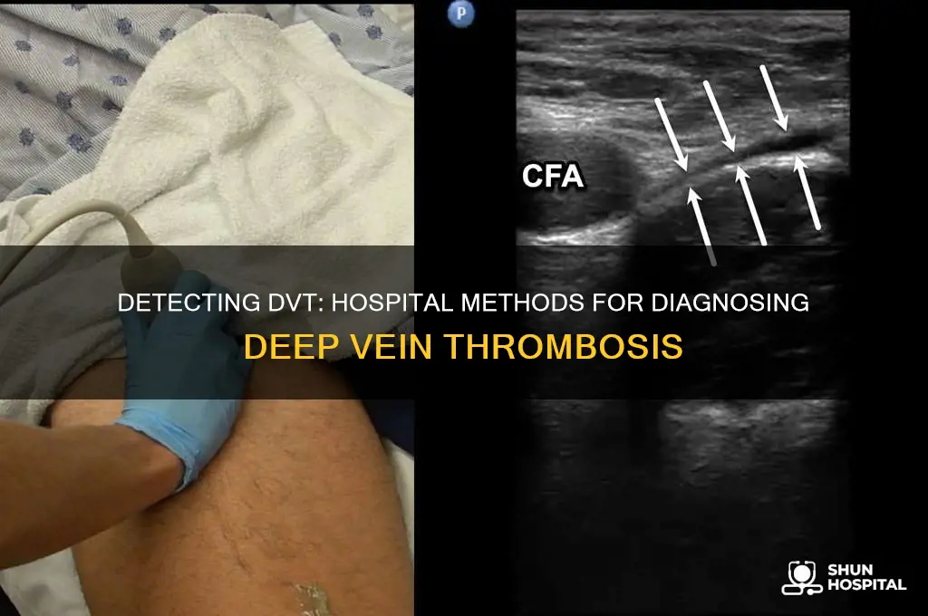 how does hospital detect dvt