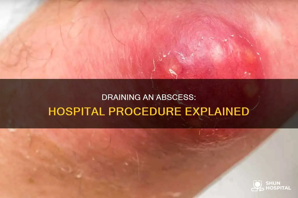 how does the hospital drain an abscess