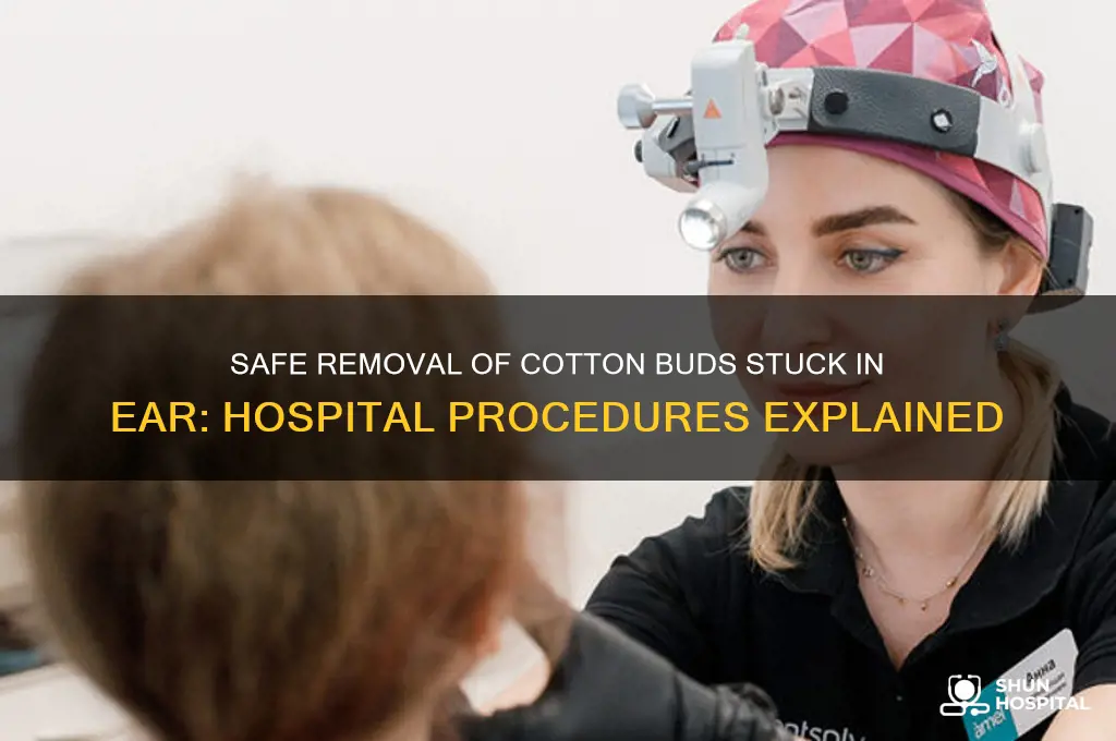 how does the hospital remove cotton bud stuck in ear