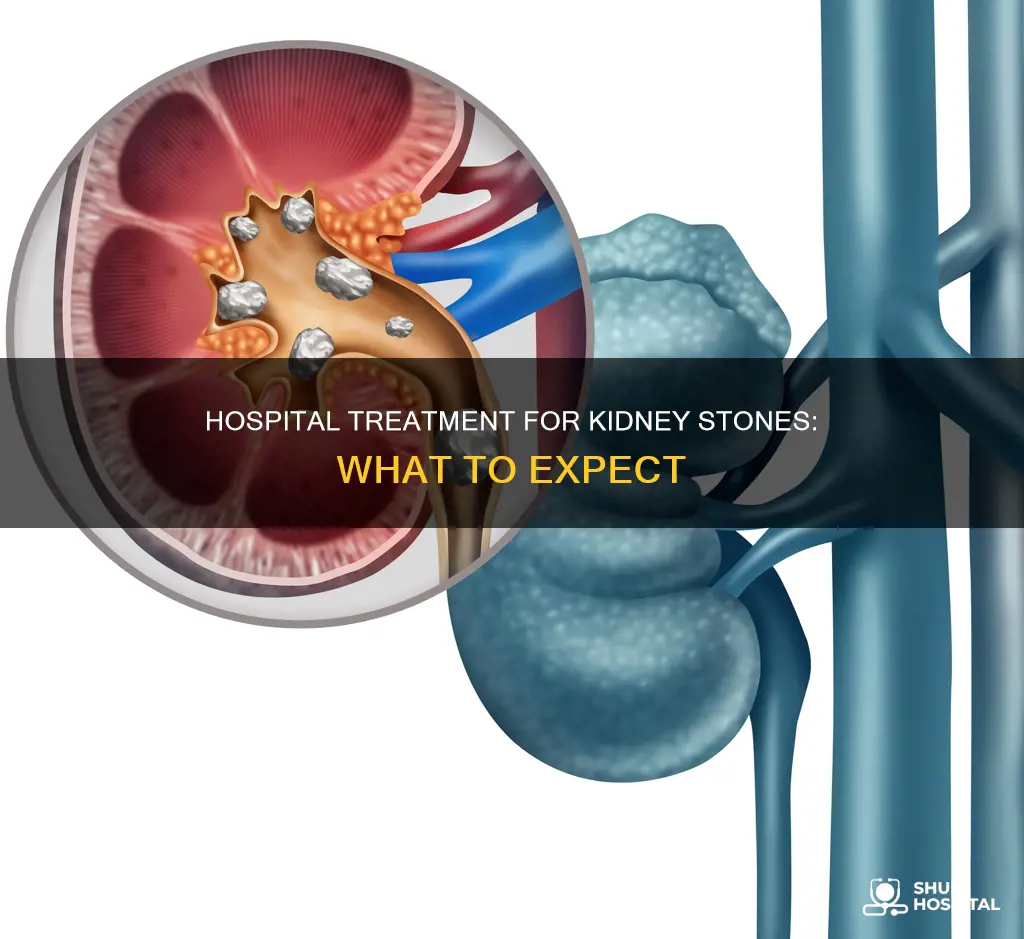 how does the hospital treat kidney stones